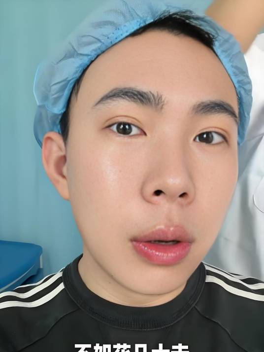 李嘴嘴zz