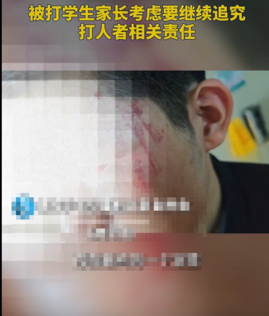 5·7运城男生被校友打伤事件