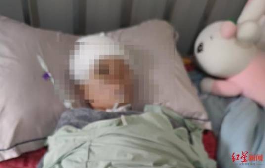 9·21金堂女孩摔倒事件