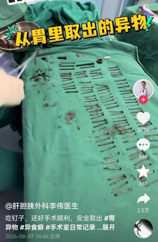 8·7云南男子吞食异物事件