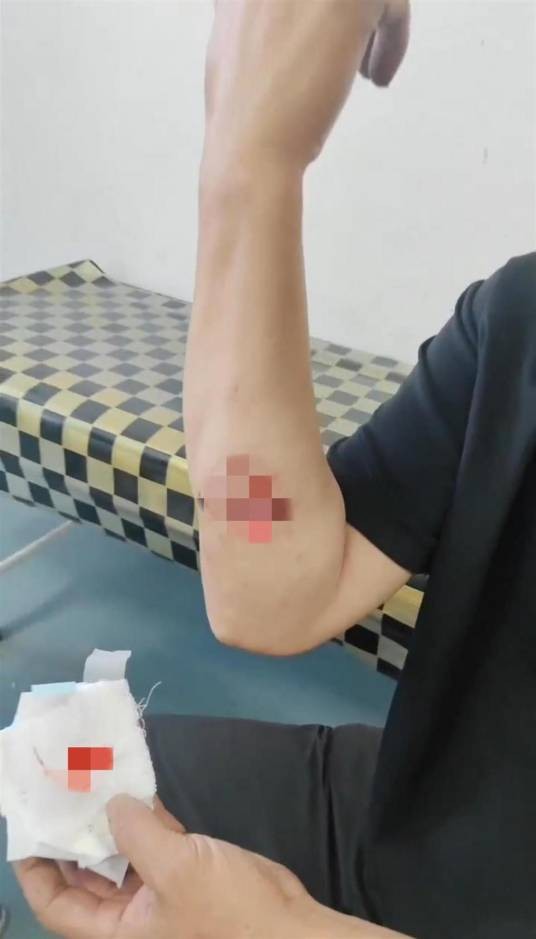 5·17货车司机被独狼咬伤事件