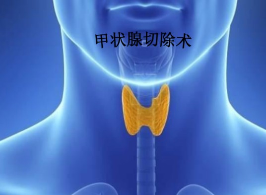 甲状腺切除