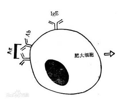 Ⅰ型变态反应
