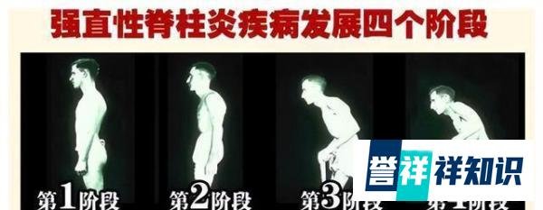 李宇春父亲回应女儿病情!