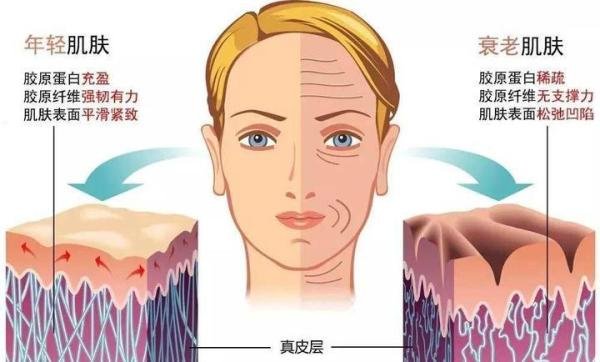 热玛吉是智商税吗?该怎么避坑?(内含福利)