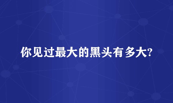 你见过最大的黑头有多大?