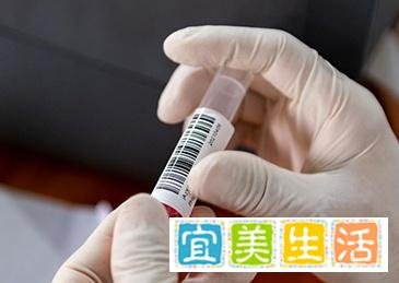 核酸混采存在弊端 多地通告取消
