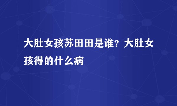 大肚女孩苏田田是谁？大肚女孩得的什么病