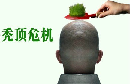 植发的费用换算后超房价，植发这项技术为什么这么贵？