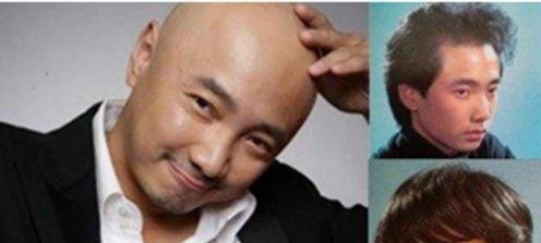 徐峥自爆脱发心酸事，并说这些生发秘方是破秘