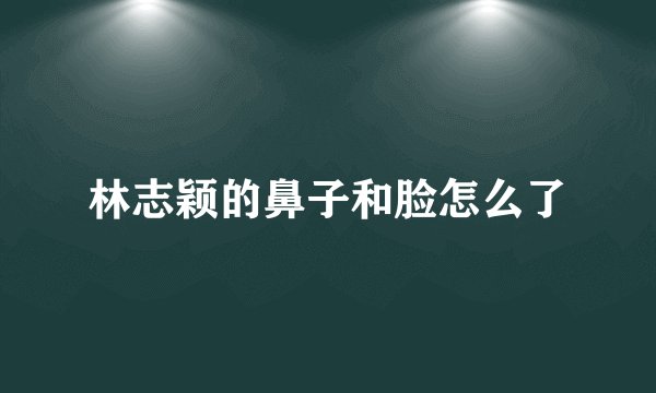 林志颖的鼻子和脸怎么了