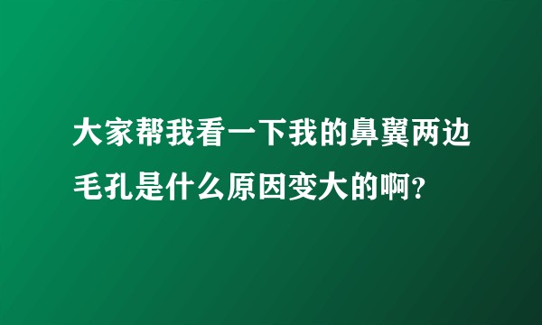 大家帮我看一下我的鼻翼两边毛孔是什么原因变大的啊?