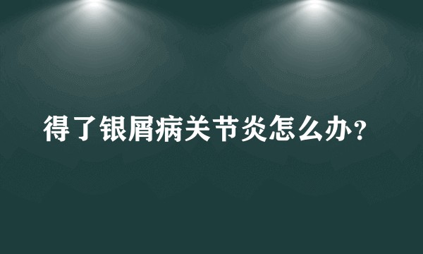 得了银屑病关节炎怎么办？