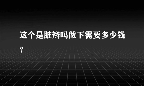 这个是脏辫吗做下需要多少钱？
